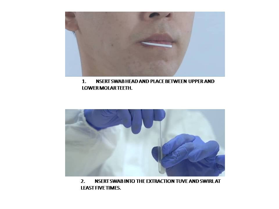SSST Amonmed Covid Saliva Self Test